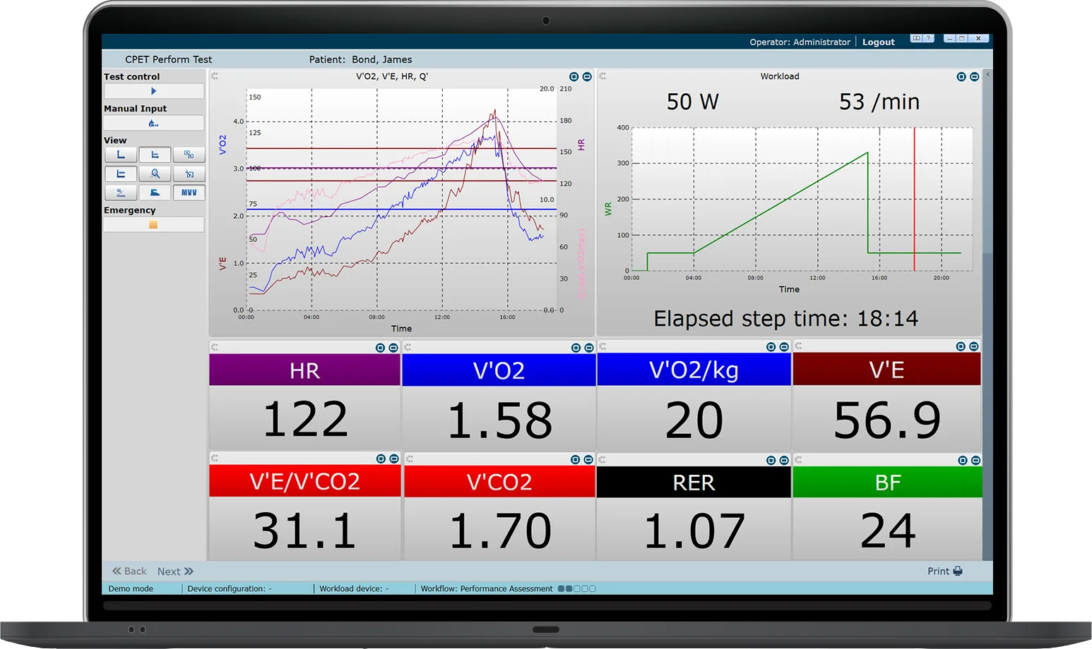MetaSoft® Studio, Testansicht mit Atemgas-Kurven, Workload und Live-Messwerten